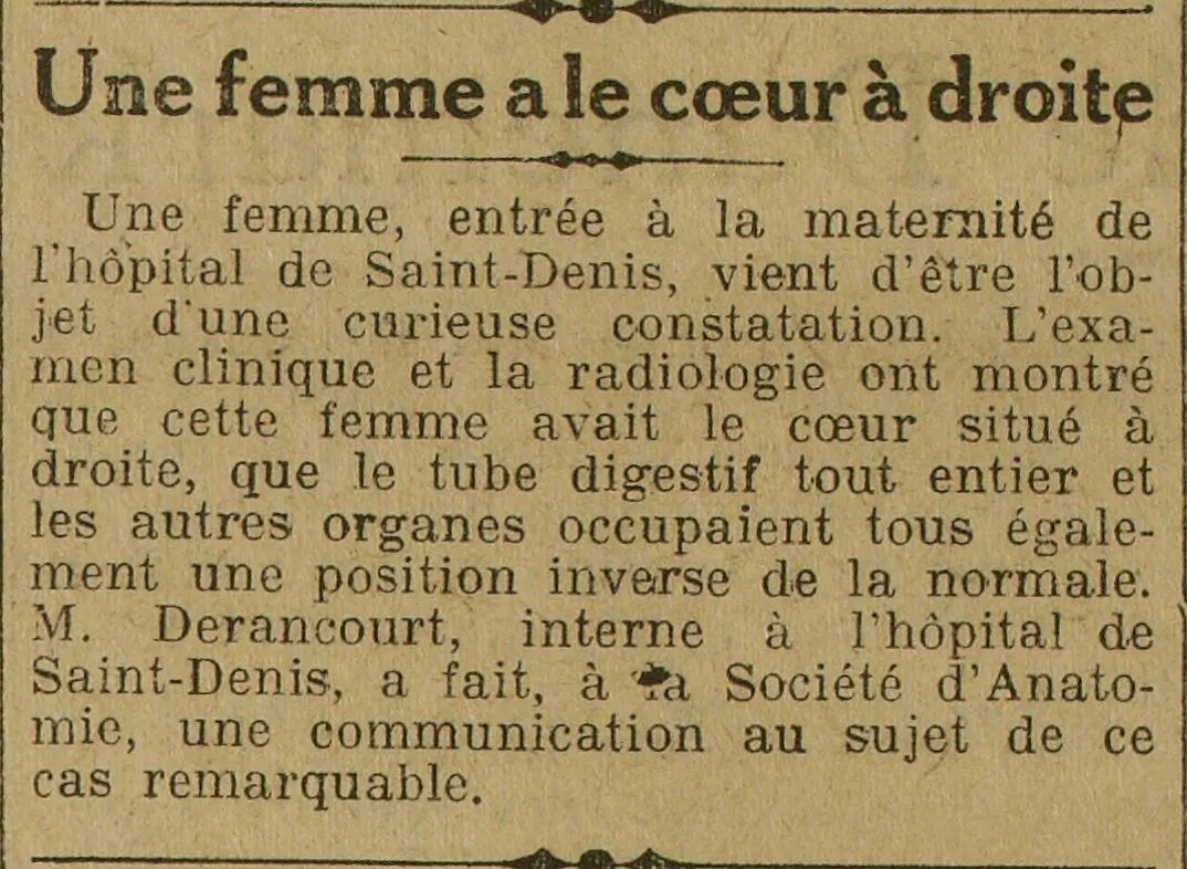 Une femme a la coeur à droite